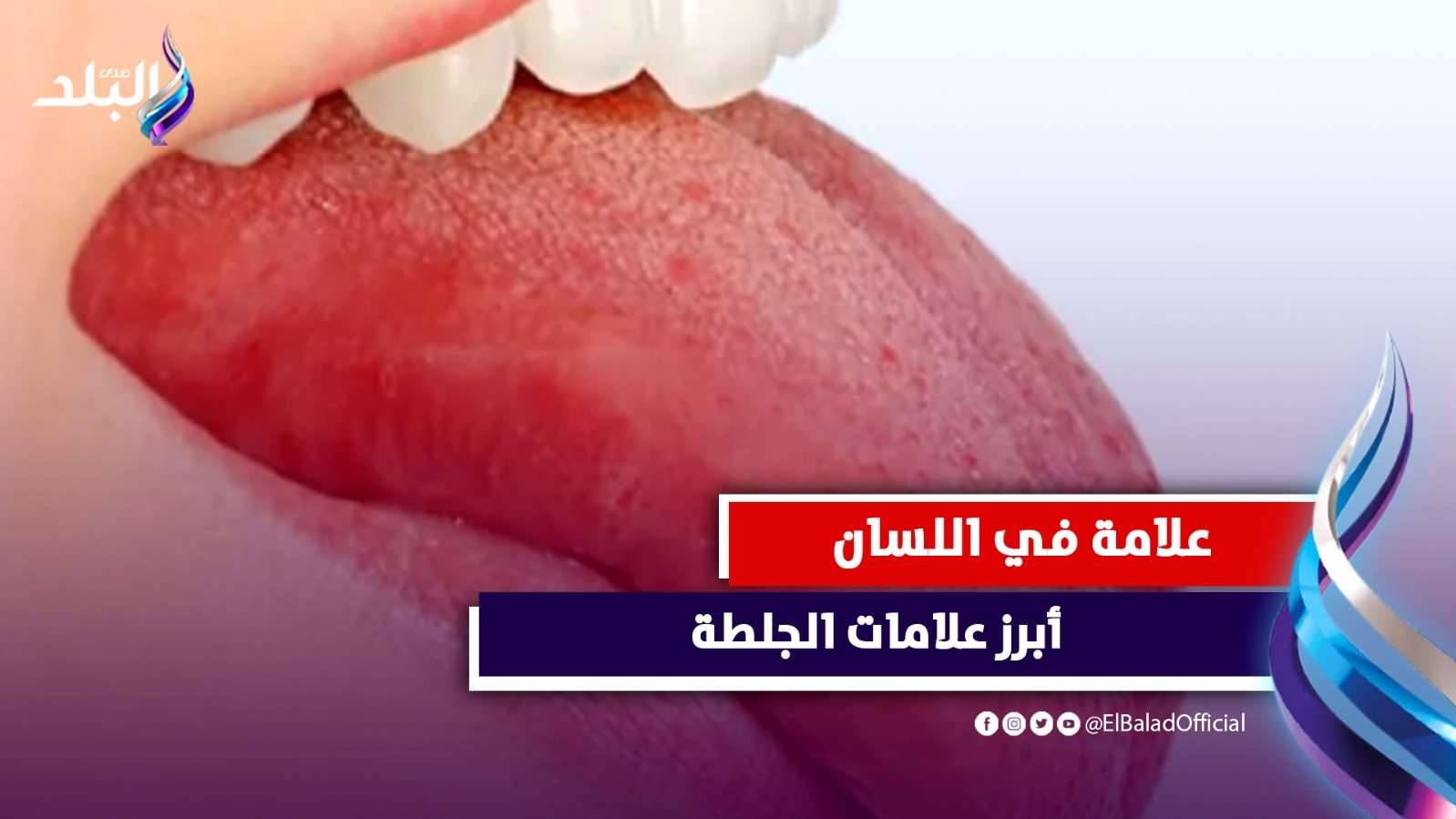 علامة في اللسان تكشف حدوث جلطة.. تعرف عليها |فيديوجراف