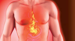 حرقان المعدة والصدر 10 أسباب و5 طرق للعلاج دون أدوية