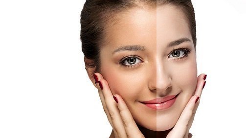 أشهر مشاكل الصيف .. إليك طرق إزالة التان بوصفة طبيعية
